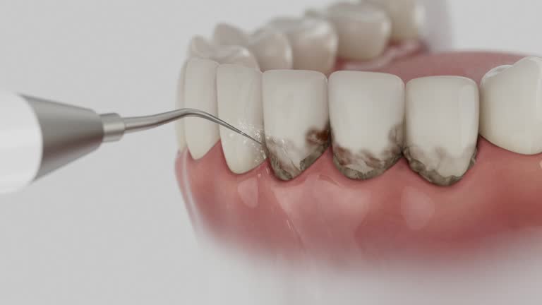 Trusted Tooth Extraction service in Hollister, CA - Dentist Open Now